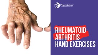 Rheumatoid Arthritis RA Signs amp Symptoms amp Associated Complications [upl. by Gnik]