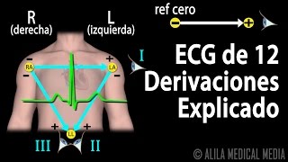 ECG de 12 Derivaciones Explicado Animación Alila Medical Media Español [upl. by Domph150]