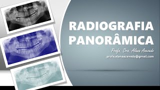 Aula Radiografia Panorâmica [upl. by Phene]