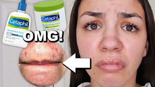 I Used Cetaphil Skincare For One Week [upl. by Shaine]