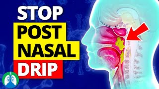 Top 10 Ways to Stop a Cough from Postnasal Drip [upl. by Urdna]