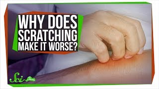 Why Does Scratching Make Itching Worse [upl. by Aneehsram]