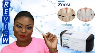 Philips ZOOM Professional AtHome Whitening  RDH ReviewDemo  Eva Tarae [upl. by Bea]