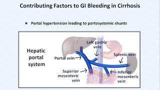 Esophageal Varices and Variceal Hemorrhage [upl. by Kissee]