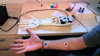 Roujin Project  InMoov Arm and EMG 1 [upl. by Ahsinrad649]