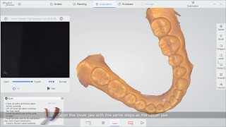 PANDA smart Intraoral Scanner  Restoration Scanning [upl. by Martha320]