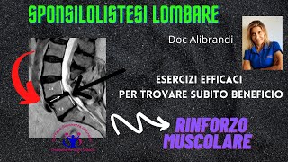 SPONDILOLISTESI E MAL DI SCHIENA LOMBAREESERCIZI DI RINFORZO [upl. by Aillimat]