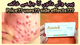 Azotek tablets honest reviewAcne Treatment skincare acne skin [upl. by Eixela49]