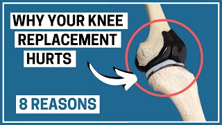 Why is your Knee Replacement painful 8 possible reasons [upl. by Anerdna]