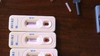 HOW TO DO HIV TEST USING THE DETERMINE HIV TESTING KIT [upl. by Tayler]