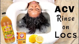 My FIRST ACV Rinse for Locs  Naturally Michy [upl. by Tandi]