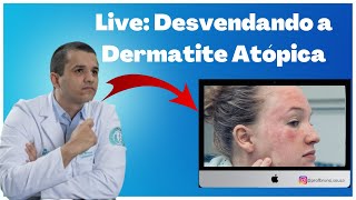 Live Dermatite Atópica  Causas Sintomas e Tratamentos com Dr Bruno Souza [upl. by Bianchi]