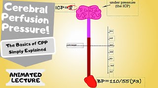 Cerebral Perfusion Pressure CPP made easy [upl. by Demp299]