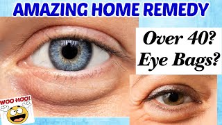 Over 40 Get Rid Of EYE BAGS amp PUFFY UNDER EYES [upl. by Lien]