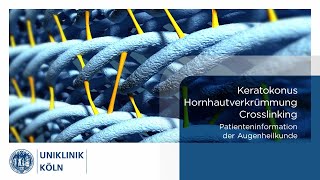 Keratokonus Hornhautverkrümmung  Crosslinking  Patienteninformation Augenklinik  Uniklinik Köln [upl. by Abernathy]