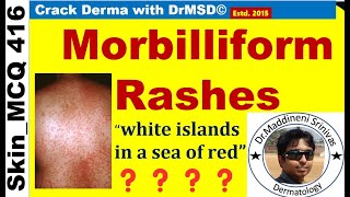 Morbilliform RASH  DENGUE  MEASLES  RUBELLA  HERPES ZOSTER  Viral Infections  MACULOPAPULAR [upl. by Lyons]