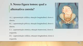 Estudo de enfermagem obstétrica estatica fetal concursoemobstetricia [upl. by Anitsua]