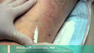 Corona COVID19 How Vein finder Works  Vein finder working principle  Diagnotherapy [upl. by Savihc]