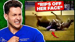 Doctor Reacts To Shocking Horse Riding Injuries [upl. by Elocaj]