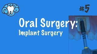 Oral Surgery  Implants  INBDE ADAT [upl. by Sletten391]