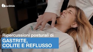 Come valuto le ripercussioni posturali di gastrite colite e reflusso [upl. by Eudo]