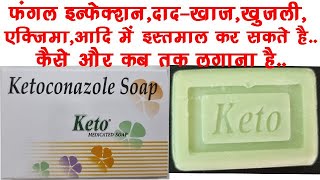 Keto Soap UsesBenefits Side Effects  Ketoconazole 2 ww Soap🔥🔥 [upl. by Eanehs]