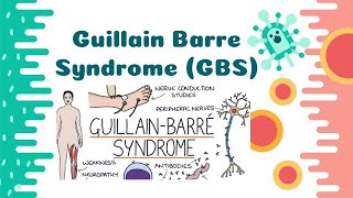 GuillainBarre Syndrome  Its Causes  Pathophysiology Risk Factors Sign amp Symptoms [upl. by Mccahill]