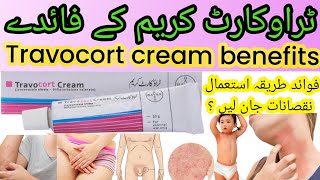 Travocort creamuses benefits inurduhindi for yeast fungal skin rashes allergyami review [upl. by Hurleigh]