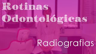 Radiografias  Rotinas Odontológicas [upl. by Anatolio940]