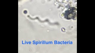 Spirillum Bacteria [upl. by Ellenaej379]