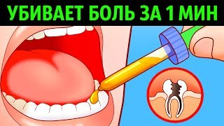 10 Способов Убить Зубную Боль за Минуту [upl. by Otis]