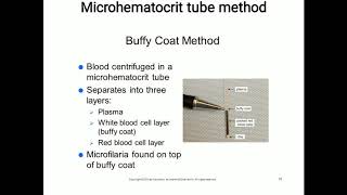 Examination for Microfilaria [upl. by Elke]