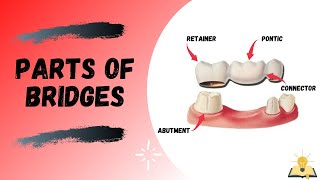 Parts of Bridge  Fixed Partial Denture FPD [upl. by Jeno539]