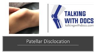 Patellar Knee Cap Dislocation Everything You Need To Know [upl. by Phylys]