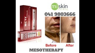 Filorga NCTF Mesotherapy [upl. by Keisling]