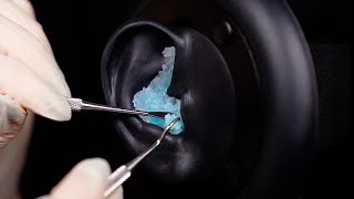 ASMR  Up close EAR CLEANING no talking Sensory Sunday [upl. by Littlejohn]