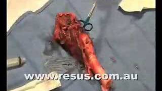 Surgical Airway on resuscomau [upl. by Saleem741]