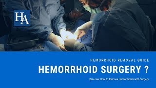 Discover How to Remove Hemorrhoids with Surgery  Hemorrhoid Removal Guide [upl. by Herrod]