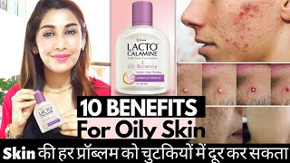 10 Uses of Lacto Calamine Lotion for Pimples Oily Skin Blackheads Acne Prone skin  Dr Menka [upl. by Cirdahc936]