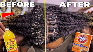 HOW TO ACV RINSE YOUR DREADLOCKS  Step By Step Tutorial [upl. by Ahsyad]