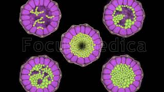 Ductal and Lobular Lesions  Animated Atlas of Breast and Gastric Cancer [upl. by Cappella]