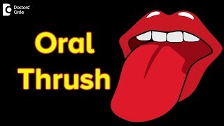 Oral thrush Causes Symptoms Treatment  Oral thrush contagious [upl. by Cassius]