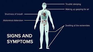 What is Heart Failure Causes Symptoms and Treatment [upl. by Magna]