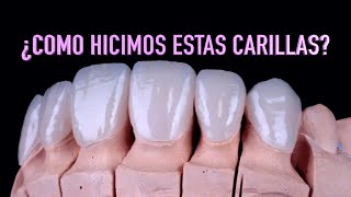 Cómo se hacen las carillas dentales  Proceso realización carillas dentalesDr Roberto Wuotto [upl. by Burley]