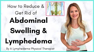 Abdominal Lymphedema and Swelling in the Stomach Treatment  By a Lymphedema Physical Therapist [upl. by Bello]