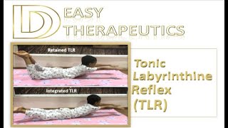 TLR Assessment and Exercises  Tonic Labyrinthine Reflex  Primitive Reflexes [upl. by Foushee467]