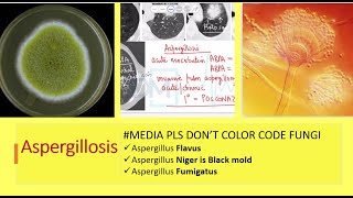 Yellow fungus  Aspergillus Flavus  Aspergillosis by Dr Marwah [upl. by Wimsatt79]