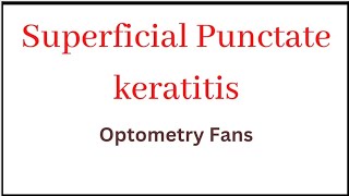 Superficial Punctate keratitis  Causes  Sign and symptoms  Treatment and management [upl. by Maxy]