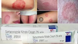 SUR ZOLE Cream Sertaconazole Nitrate Cream 2 ww [upl. by Ignace]