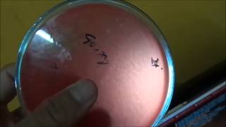 Estreptococos BHemolíticos en Cultivo Agar Sangre [upl. by Divine]